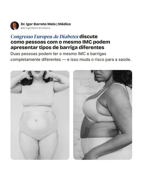 Médico, slide 1 de 7: Mesmo IMC, tipos de barriga diferentes: o que o Congresso Europeu de Diabetes discutiu